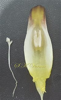 Fertile stamen and style and stigma
